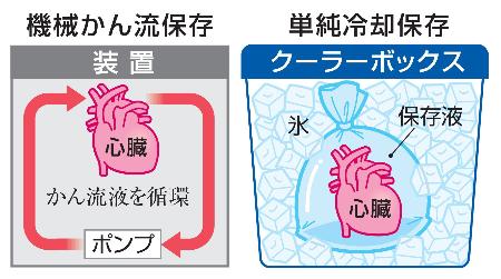 　心臓・機械かん流保存と単純冷却保存
