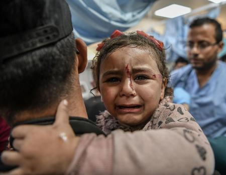 イスラエル軍の空爆後、病院で治療を待つパレスチナ人の子ども=2023年、パレスチナ自治区ガザ南部ハンユニス(ゲッティ=共同)