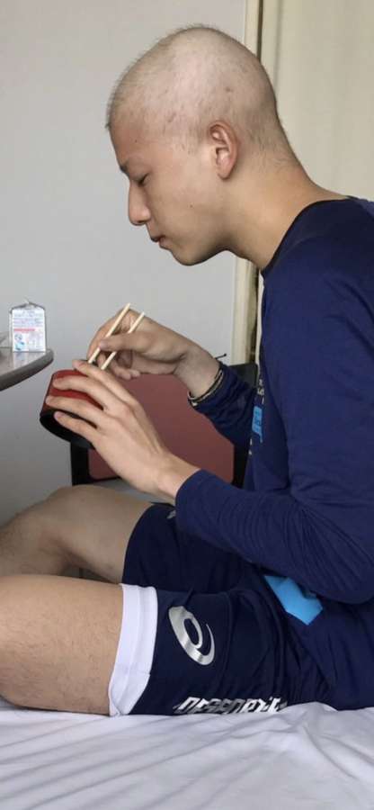 入院中の横田慎太郎さん。抗がん剤と放射線の二つの治療を同時に行い、髪の毛などが抜けてしまった